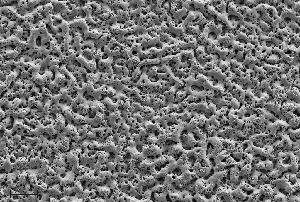 Elektronenmikroskopische Aufnahme der neuartigen porösen, bioaktiven Titanoxidoberfläche. Bild: Innovent e.V. 