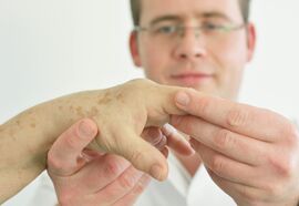 Mindestens 800.000 Menschen in Deutschland leiden z.B. unter Rheumatoider Arthritis, bei der etwa Schmerzen in den Fingergelenken auftreten. In der neuen Rheuma-Tagesklinik am Universitätsklinikum Jena wird nun die Diagnose und Therapie gebündelt. Foto: UKJ/Szabo.