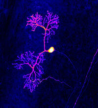 Nervenzelle im Mäusegehirn: Ein dynamisches Zellgerüst formt und stabilisiert die vielen feinen Verästelungen, die die Erregungsleitung von Zelle zu Zelle ermöglichen. (Quelle: Inst. f. Biochemie I/UKJ)