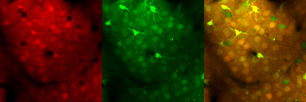Fluoreszenzfarbstoffe machen aktive Neuronen in der Sehrinde der Maus sichtbar. Bild: AG BioImaging/UKJ