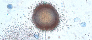 Mikroskopische Aufnahme von Schwarzschimmel, aspergillus niger. A. Hopf, AG Raumklimatologie